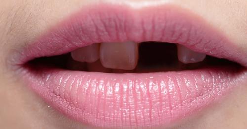 safe_image (6)